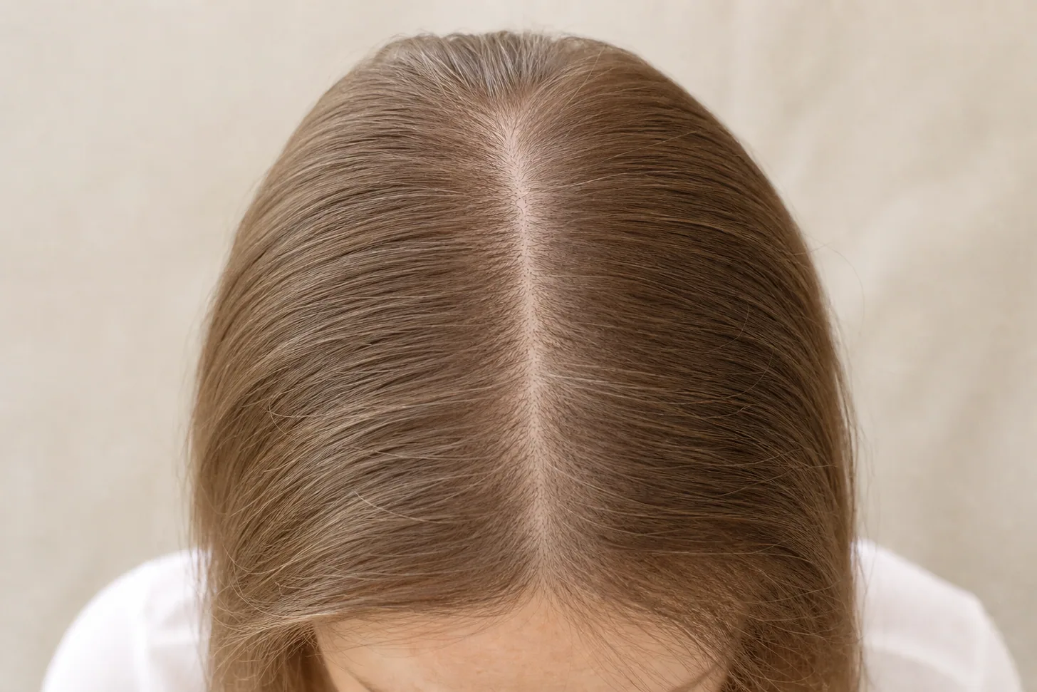 Overhead view of a centre part in fine light brown hair with the scalp faintly visible along the part line