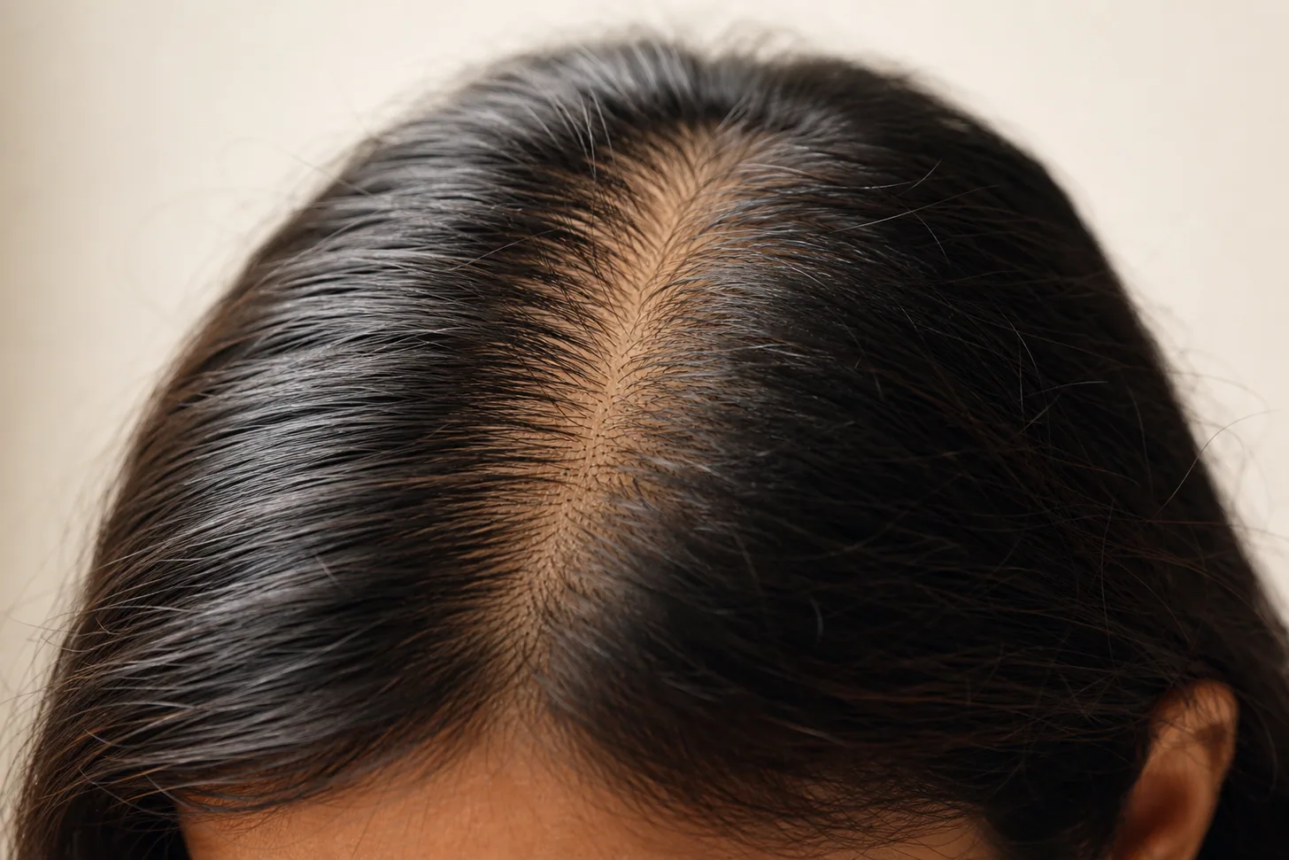 The hair growth cycle explained for fine hair