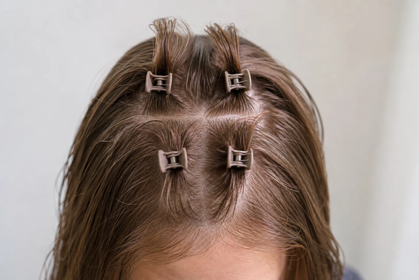 Small volume root clips set in horizontal sections across the crown of fine light brown hair, seen from above